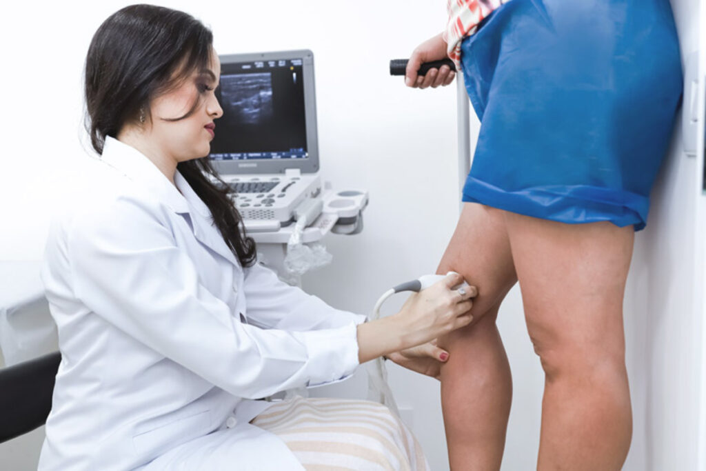 Médica explica uso do Endolaser para tratar veia safena