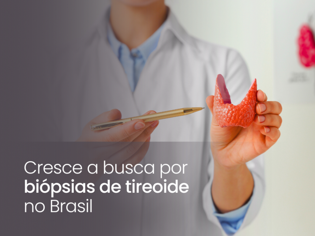 Médico segura modelo de tireoide.