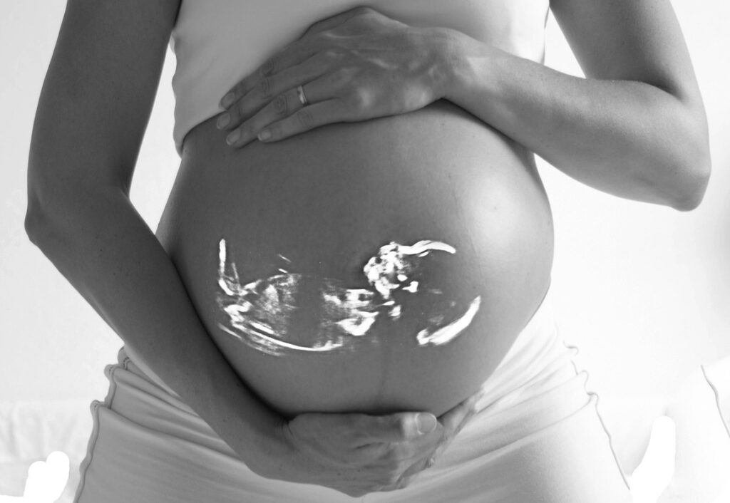 Equipes de cirurgia fetal realizam procedimento inédito