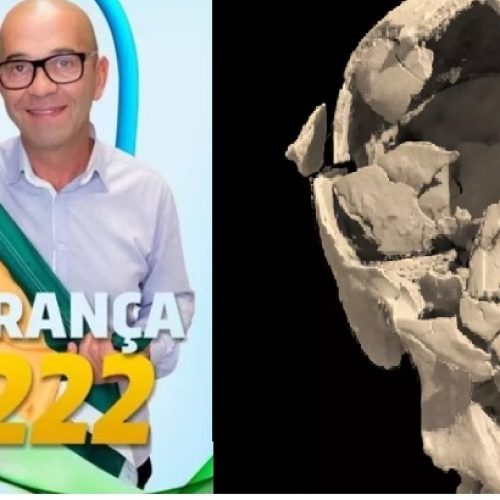 "Tiü França",: candidato a vereador pelo PL e projeção de como ficou o crânio dele com a explosão