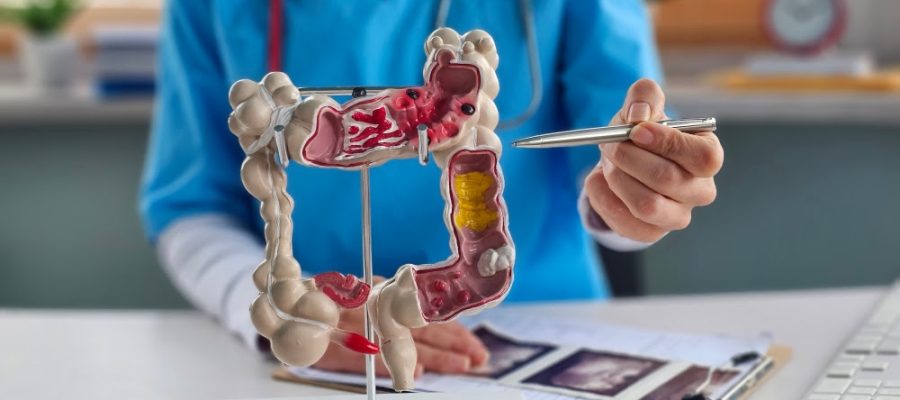 Idade é principal fator de risco para morte por câncer colorretal